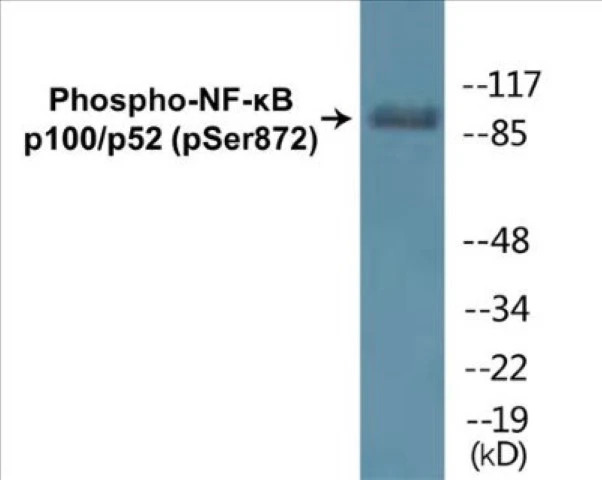 NF-kB p100 / p52 (phospho Ser872) Cell Based ELISA Kit (A102606-296)