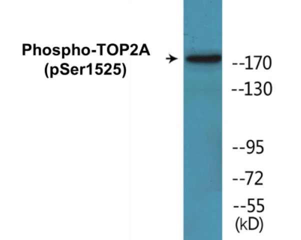 TOP2A (phospho Ser1525) Cell Based ELISA Kit (A102089-296)