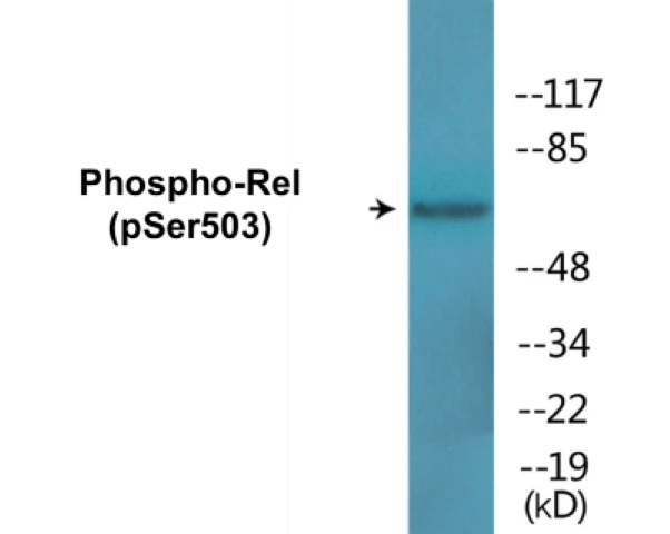 Rel (phospho Ser503) Cell Based ELISA Kit (A102754-296)