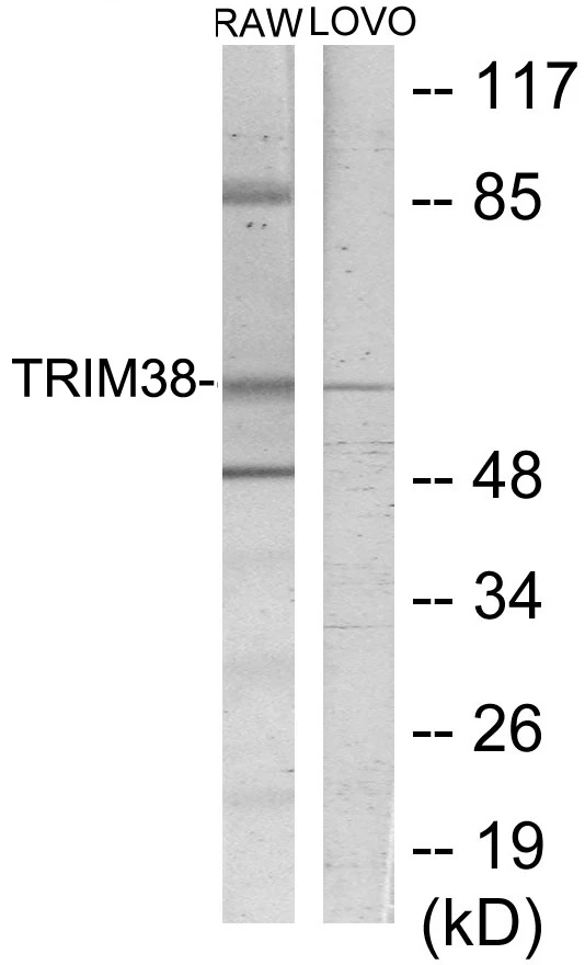 TRIM38 Cell Based ELISA Kit (A103416-96)