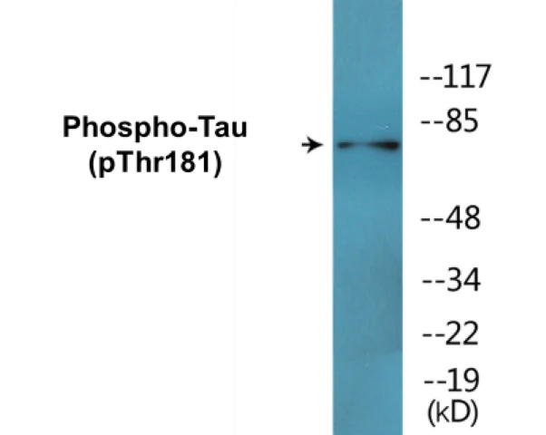 Tau (phospho Thr181) Cell Based ELISA Kit (A102752-296)