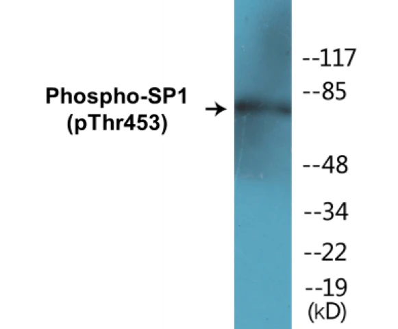 SP1 (phospho Thr453) Cell Based ELISA Kit (A102423-296)