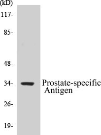 Prostate-specific Antigen Cell Based ELISA Kit (A103613-96)