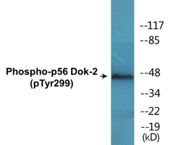 p56 Dok-2 (phospho Tyr299) Cell Based ELISA Kit (A102688-296)