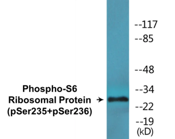 S6 Ribosomal Protein (phospho Ser235 + Ser236) Cell Based ELISA Kit (A102063-296)