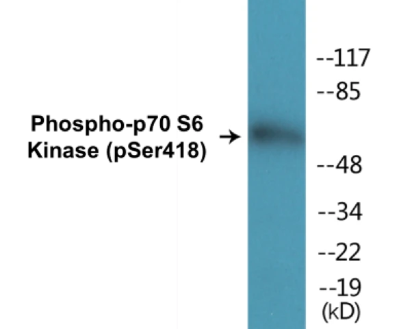 p70S6 Kinase (phospho Ser418) Cell Based ELISA Kit (A102489-296)