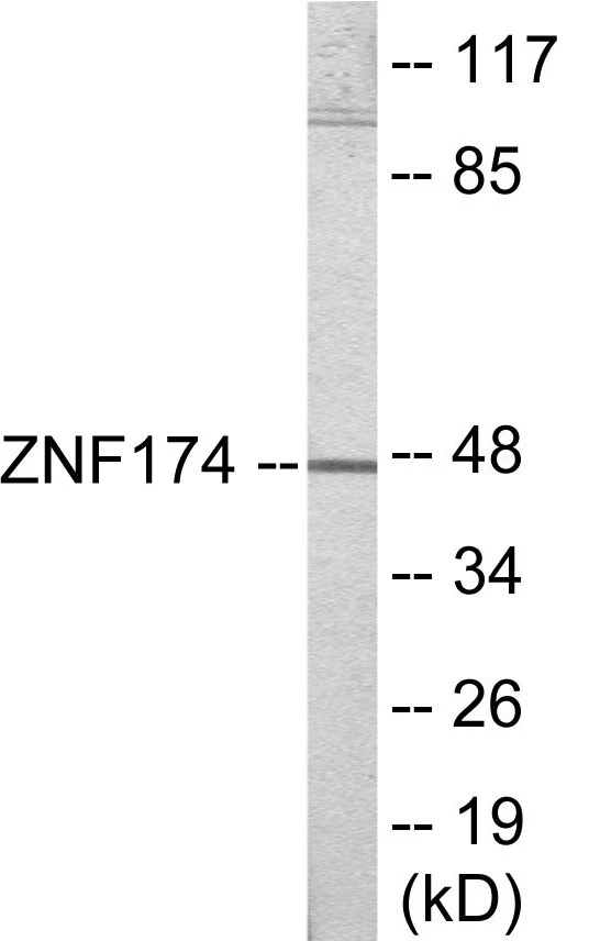 ZNF174 Cell Based ELISA Kit (A103660-96)