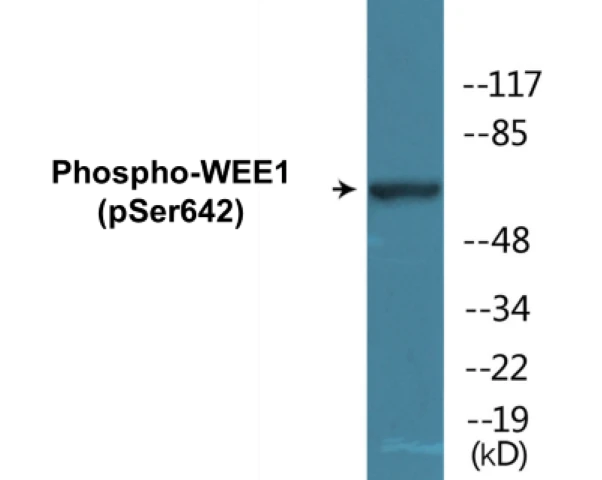 WEE1 (phospho Ser642) Cell Based ELISA Kit (A102322-296)