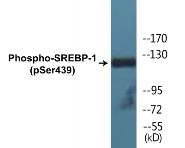 SREBP-1 (phospho Ser439) Cell Based ELISA Kit (A102694-296)