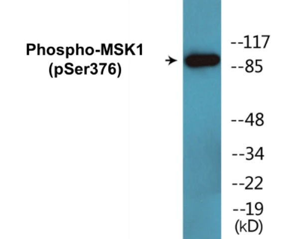 MSK1 (phospho Ser376) Cell Based ELISA Kit (A102654-296)