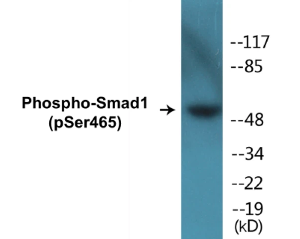 Smad 1 (phospho Ser465) Cell Based ELISA Kit (A102091-296)