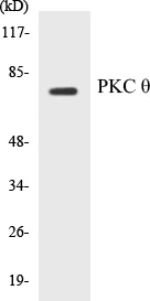 PKC theta Cell Based ELISA Kit (A102944-96)