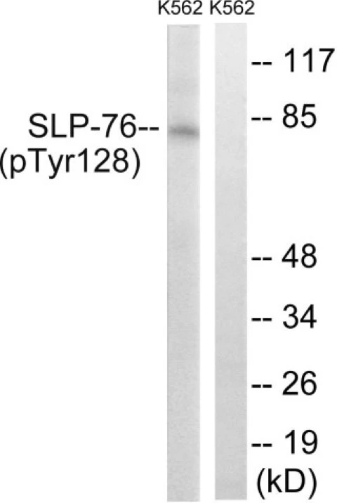 SLP-76 (phospho Tyr128) Cell Based ELISA Kit (A103778-296)