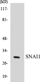 SNAI1 Cell Based ELISA Kit (A103430-96)