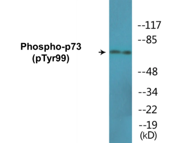 p73 (phospho Tyr99) Cell Based ELISA Kit (A102680-296)