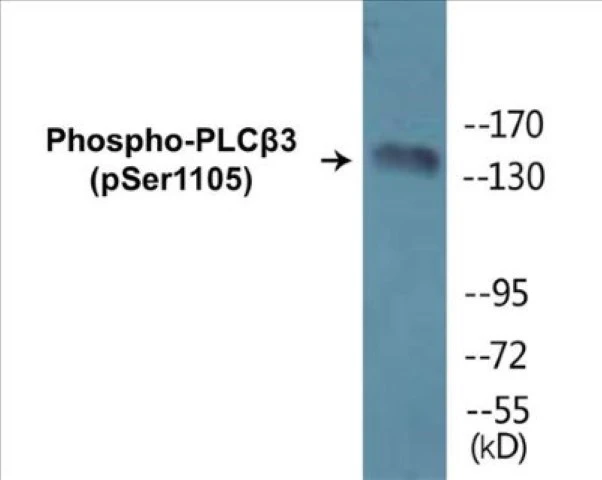 PLC beta 3 (phospho Ser1105) Cell Based ELISA Kit (A102498-296)