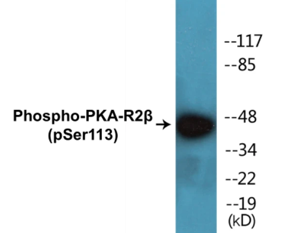 PKA-R2 beta (phospho Ser113) Cell Based ELISA Kit (A102503-296)