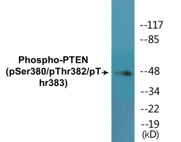 PTEN (phospho Ser380 + Thr382 + Thr383) Cell Based ELISA Kit (A102065-296)