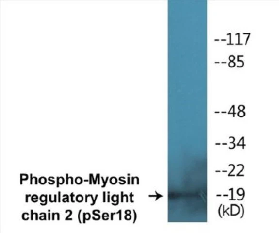 Myosin regulatory light chain 2 (phospho Ser18) Cell Based ELISA Kit (A102037-296)