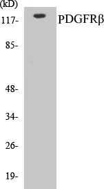 PDGFR beta Cell Based ELISA Kit (A102877-96)