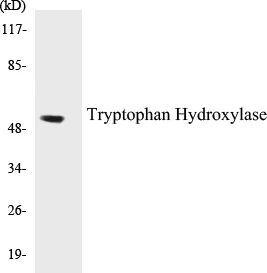 Tryptophan Hydroxylase Cell Based ELISA Kit (A102799-96)