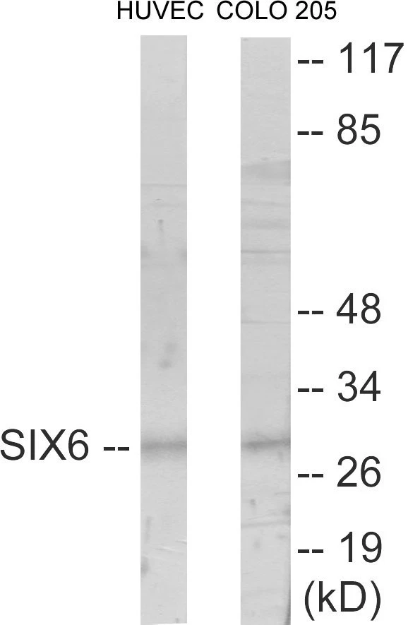 SIX6 Cell Based ELISA Kit (A103270-96)