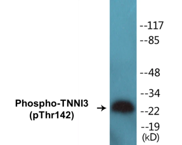 TNNI3 (phospho Thr142) Cell Based ELISA Kit (A102172-296)