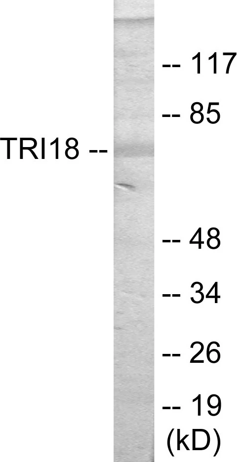 TRI18 Cell Based ELISA Kit (A103129-96)