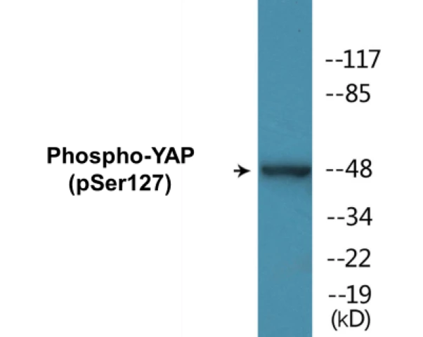 YAP (phospho Ser127) Cell Based ELISA Kit (A102383-296)