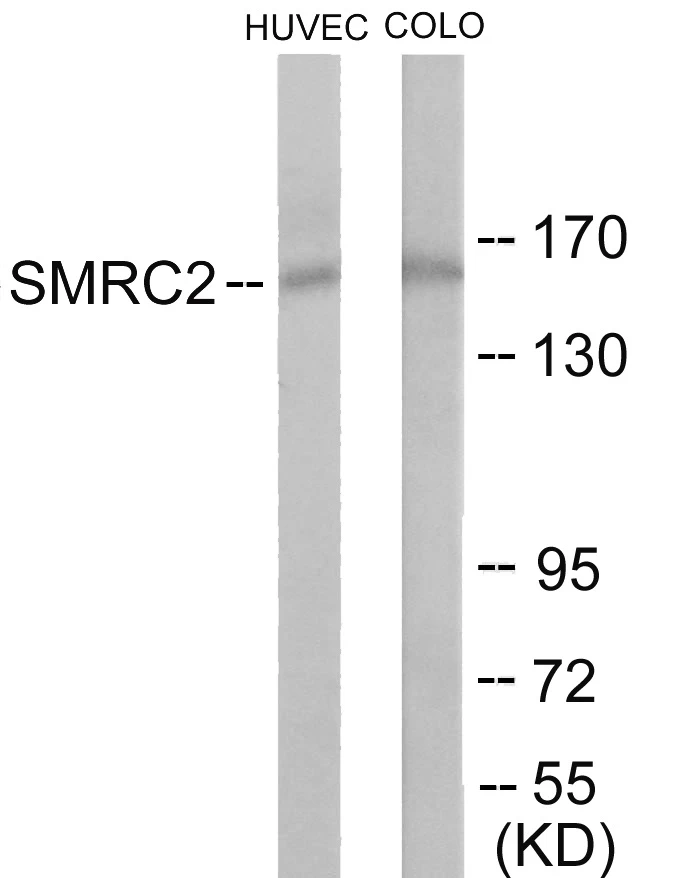 SMRC2 Cell Based ELISA Kit (A103486-96)