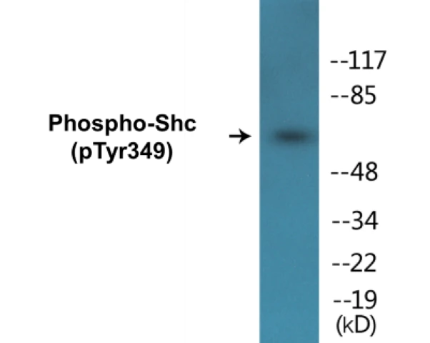 Shc (phospho Tyr349) Cell Based ELISA Kit (A102411-296)