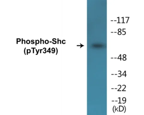 Shc (phospho Tyr349) Cell Based ELISA Kit (A102411-296)