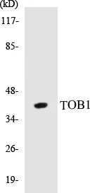 TOB1 Cell Based ELISA Kit (A103260-96)