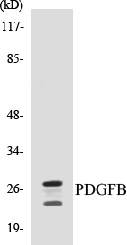 PDGFB Cell Based ELISA Kit (A103044-96)