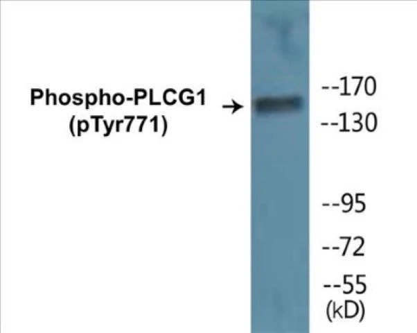 PLCG1 (phospho Tyr771) Cell Based ELISA Kit (A102167-296)