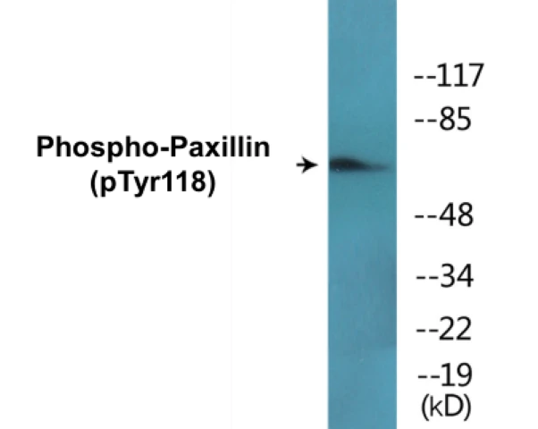 Paxillin (phospho Tyr118) Cell Based ELISA Kit (A102589-296)