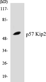 p57 Kip 2 Cell Based ELISA Kit (A103386-96)