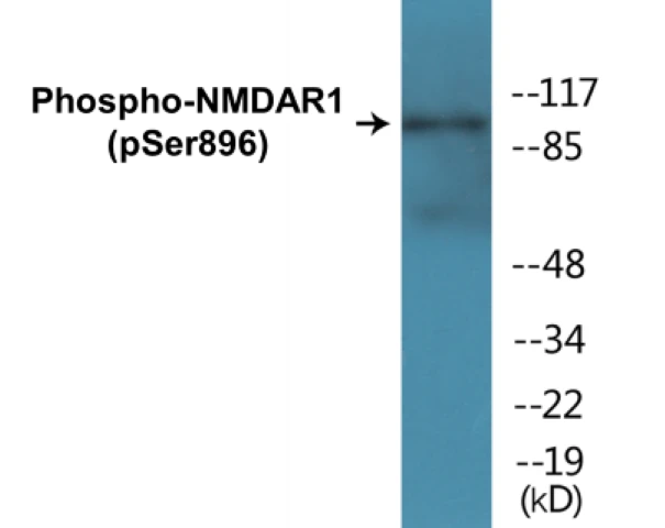 NMDAR1 (phospho Ser896) Cell Based ELISA Kit (A102096-296)