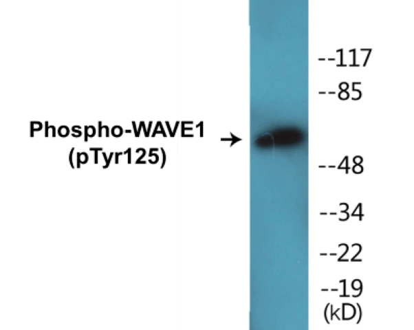 WAVE1 (phospho Tyr125) Cell Based ELISA Kit (A102173-296)