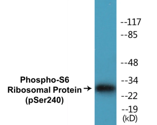 S6 Ribosomal Protein (phospho Ser240) Cell Based ELISA Kit (A102459-296)