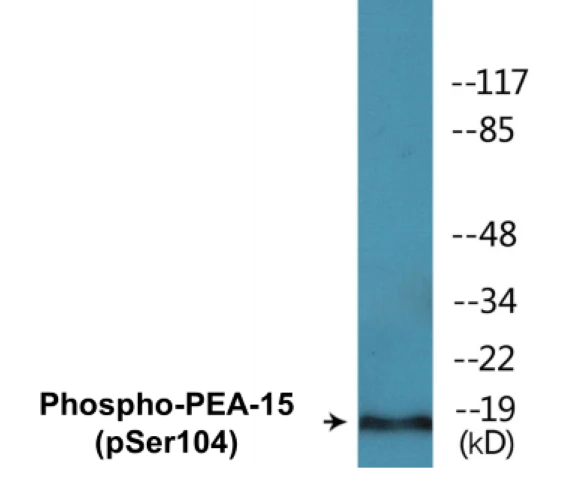 PEA-15 (phospho Ser104) Cell Based ELISA Kit (A102097-296)