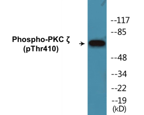 PKC zeta (phospho Thr410) Cell Based ELISA Kit (A102572-296)