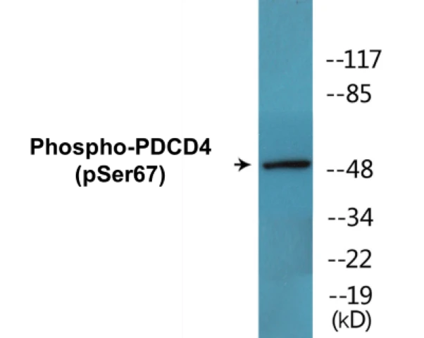 PDCD4 (phospho Ser67) Cell Based ELISA Kit (A102321-296)