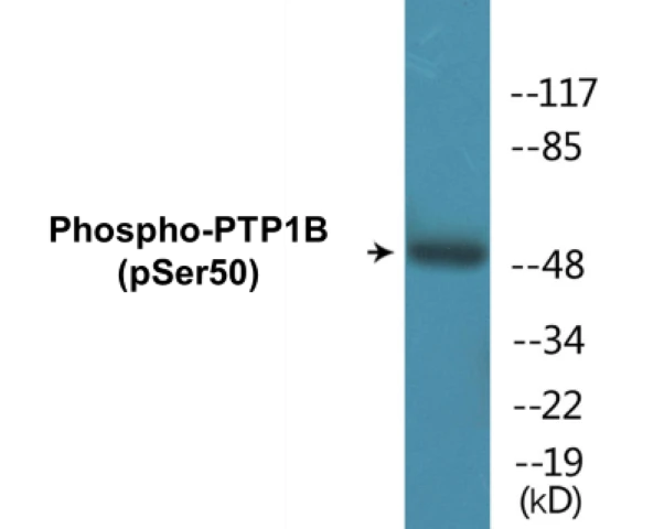 PTP1B (phospho Ser50) Cell Based ELISA Kit (A102308-296)