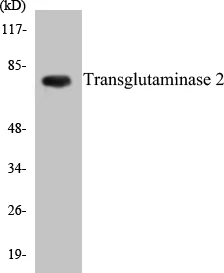 Transglutaminase2 Cell Based ELISA Kit (A103364-96)