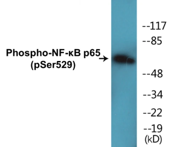 NF-kB p65 (phospho Ser529) Cell Based ELISA Kit (A103770-296)