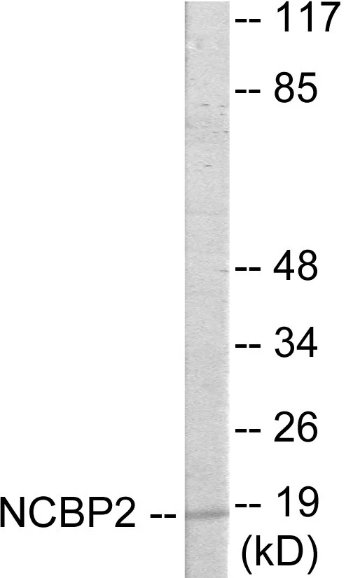 NCBP2 Cell Based ELISA Kit (A103471-96)