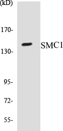 SMC1 Cell Based ELISA Kit (A103531-96)