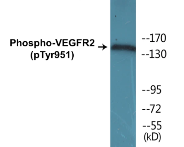 VEGFR2 (phospho Tyr951) Cell Based ELISA Kit (A102598-296)