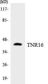 TNR16 Cell Based ELISA Kit (A103137-96)